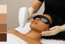 Laser hair removal: How to choose the right treatment plan by skin type and zone