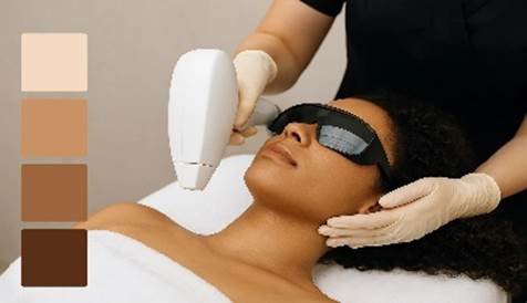 Laser hair removal: How to choose the right treatment plan by skin type and zone