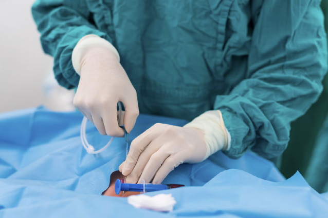 Understanding Central Line IV in Modern Healthcare