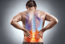 How Multidisciplinary Care Improves Back Pain Outcomes