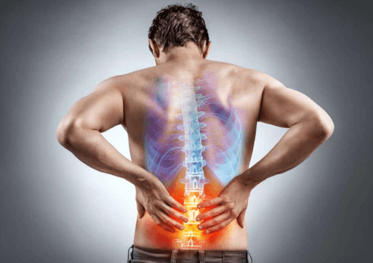 How Multidisciplinary Care Improves Back Pain Outcomes